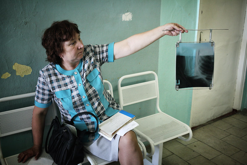 В больнице Пудожа, сделанный рентген плеча Артема